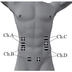 placement-electrode-abdominaux-stress