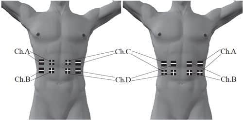 placement-electrode-abdominaux