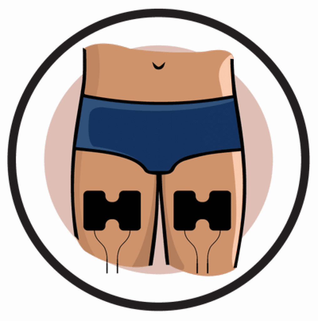 placement-electrode-cuisse